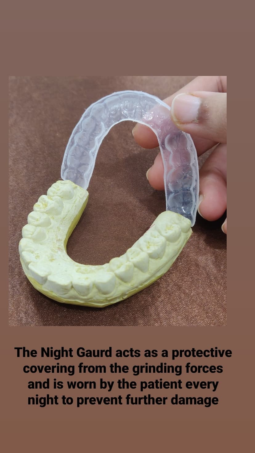 Night gaurd and bite gaurds